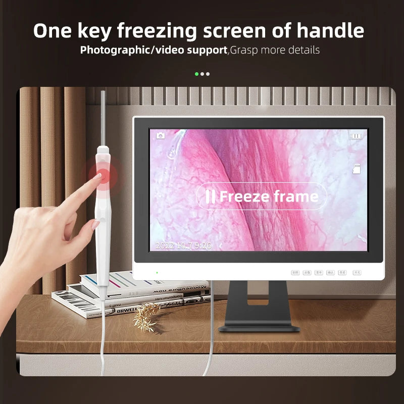 Endoscope Ear wax Removal Tool Ear Camera otoscope with monitor