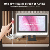 Endoscope Ear wax Removal Tool Ear Camera otoscope with monitor