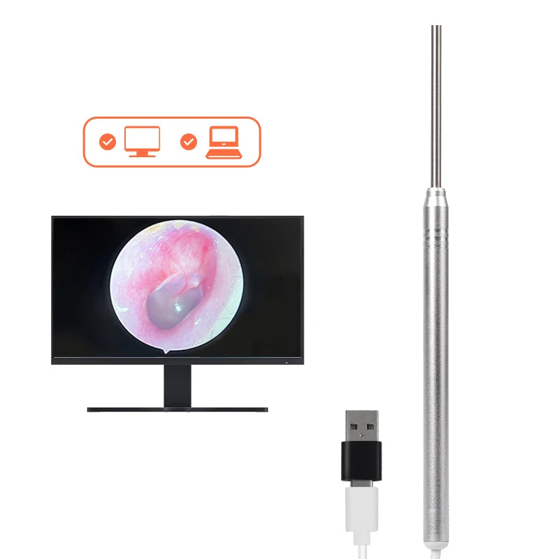 Otoscope Camera 3.3mm 1 Million Pixels Inspection Video Ear Wax Removal Tool Ear Endoscope
